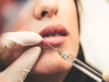 Read more about the article Botox & Fillers: Difference?